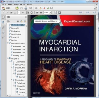 Myocardial Infarction A Companion to Braunwald"s Heart Disease