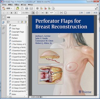 Perforator Flaps for Breast Reconstruction