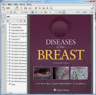 Diseases of the Breast 5th Edition