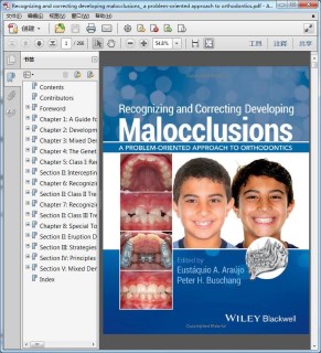 Recognizing and correcting developing malocclusions_ a problem-oriented approach to orthodontics