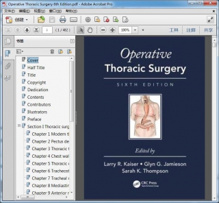 Operative Thoracic Surgery 6th Edition