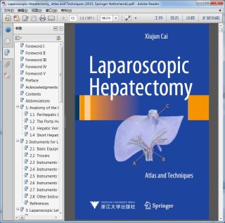 Laparoscopic Hepatectomy_ Atlas and Techniques