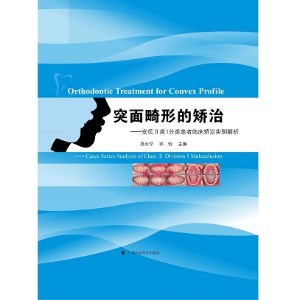 突面畸形的矫治 安氏II类1分类患者临床矫治实例解析