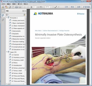 Minimally Invasive Plate Osteosynthesis 2nd Edition