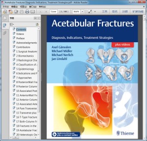 Acetabular Fractures Diagnosis, Indications, Treatment Strategies