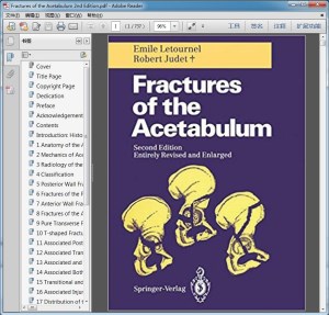 Fractures of the Acetabulum 2nd Edition