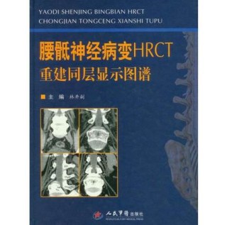 腰骶神经病变HRCT 重建同层显示图谱