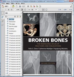 Broken Bones - The Radiologic Atlas of Fractures and Dislocations 2nd Edition