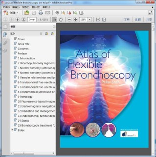 Atlas of Flexible Bronchoscopy, 1st ed