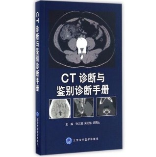 CT诊断与鉴别诊断手册