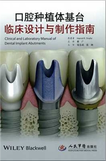 口腔种植体基台临床设计与制作指南