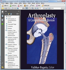 Arthroplasty A Comprehensive Review_by Vaibhav Bagaria 2016_PDF扫