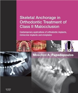 Skeletal Anchorage in Orthodontic Treatment 2015