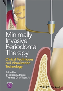 Minimally Invasive Periodontal Therapy 2015
