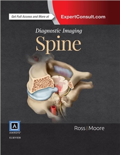 Diagnostic Imaging Spine 3e 2015