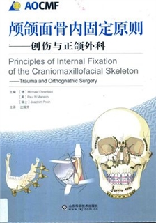 颅颌面骨内固定原则 创伤与正颌外科