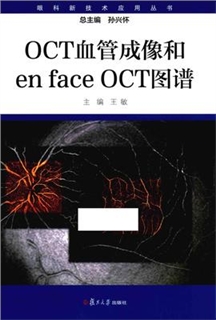 OCT血管成像和enface OCT图谱