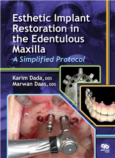 Esthetic Implant Restoration in the Edentulous 2014