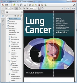 Lung Cancer 4th Edition 2014