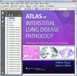 Atlas of Interstitial Lung Disease Pathology 2014