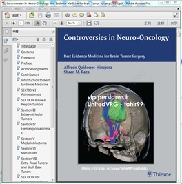 Controversies in Neuro-Oncology 2014