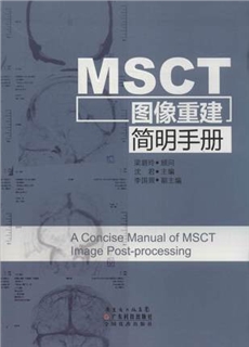 MSCT图像重建简明手册