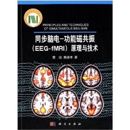 同步脑电  功能磁共振（EEG-fMRI）原理与技术