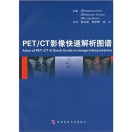 PET CT影像快速解析图谱