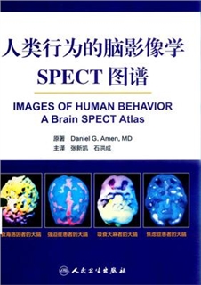 人类行为的脑影像 大脑SPECT图谱 翻译版