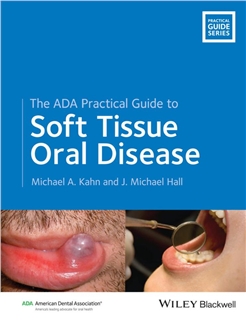 ADA Practical Guide to Soft Tissue Oral Disease 2014