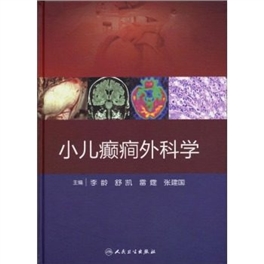 小儿癫痫外科学