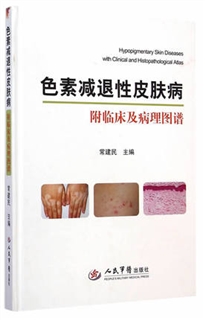 色素减退性皮肤病 附临床及病理图谱