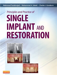 Single Implant and Restorations 2013