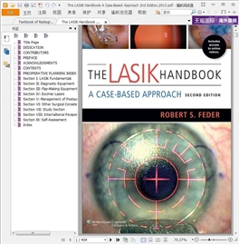 The LASIK Handbook A Case-Based Approach 2ed 2013