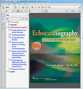 Echocardiography  A Case-Based Review 2E 2013