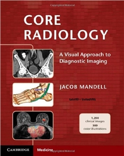 Core Radiology A Visual Approach to Diagnostic Imaging 2013