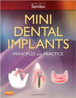 Mini Dental Implants - Principles and Practice, 1E (2013)