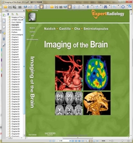 Imaging of the Brain-Expert Radiology Series, 1e 2013