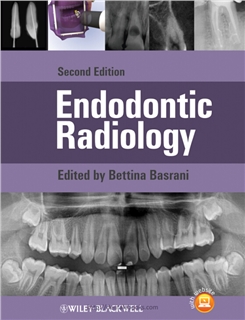 Endodontic Radiology 2nd Edition