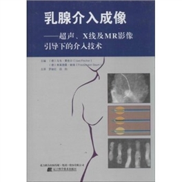 乳腺介入成像  超声、X线及MR影 像引导下的介入技术