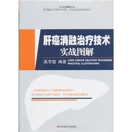 肝癌消融治疗技术实战图解