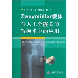 Zweymüller假体在人工全髋关节置换术中的应用