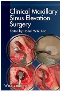 Clinical Maxillary Sinus Elevation Surgery 2014