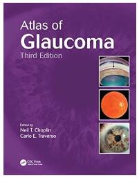 Atlas of Glaucoma, Third Edition 2014