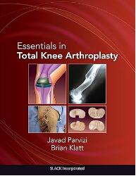 Essentials in Total Knee Arthroplasty