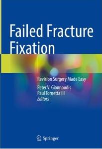 Failed Fracture Fixation_ Revision Surgery Made Easy 2024（骨折固定失败 简化翻修手术）