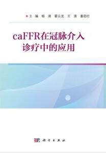 CaFFR在冠脉介入诊疗中的应用