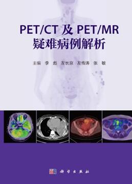 PET_CT及PET_MR疑难病例解析