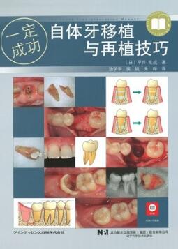自体牙移植与再植技巧