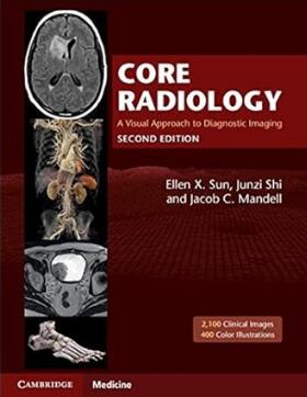 Core Radiology A Visual Approach to Diagnostic Imaging 2nd Edition 2021（核心放射学 影像诊断图解教程 第2版）